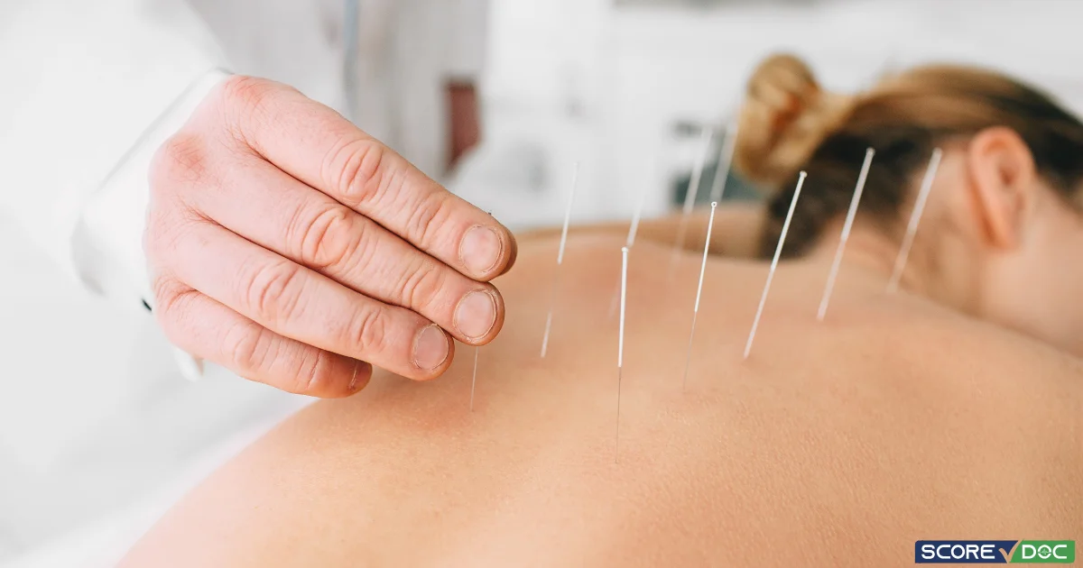 Acupuncture Practices